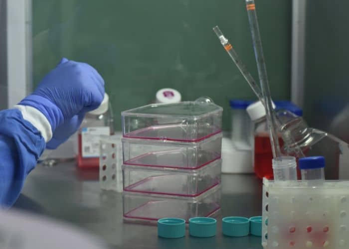 Células asesinas naturales Tratamiento NK en México