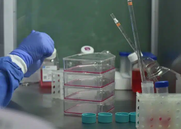 Natural Killer Cells NK Treatment in Mexico