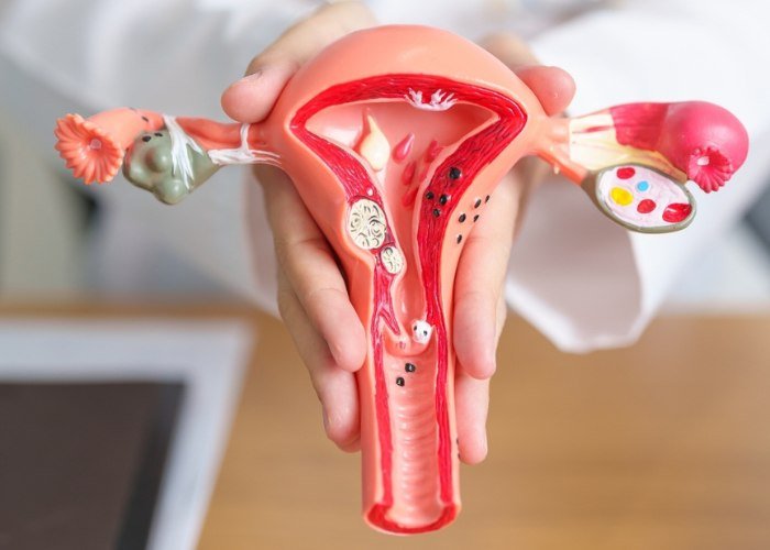 Alternative Cervical ovarian Cancer Treatment in Mexico